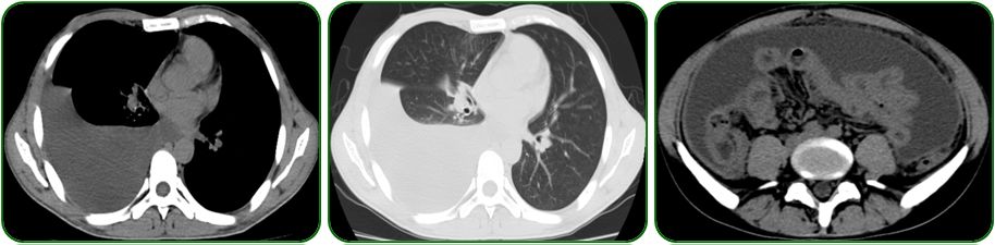 同为同龄人命运各不同,同为双胞胎命运却不同