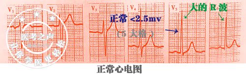 心电图秒懂,心电图零基础都秒懂