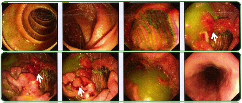 同为同龄人命运各不同,同为双胞胎命运却不同