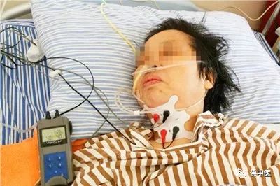 「专业」脑干梗塞合并吞咽障碍,脑病科吞咽专科护士有妙招