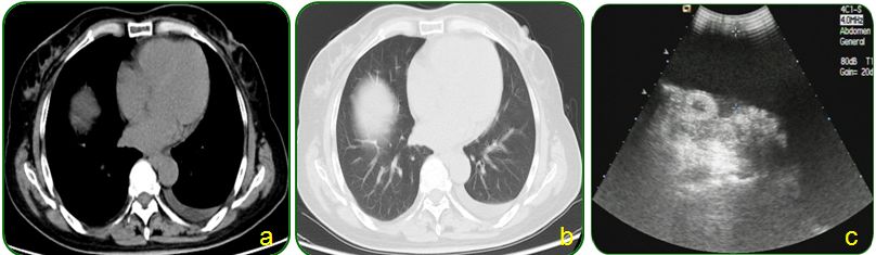 同为同龄人命运各不同,同为双胞胎命运却不同