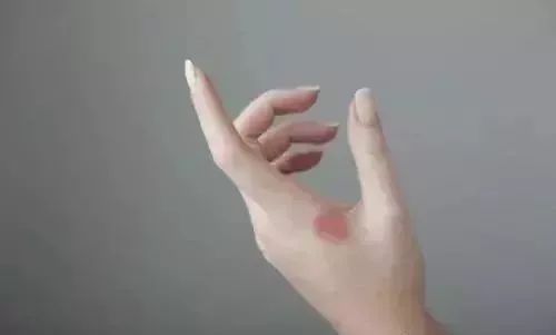 一块钱的红霉素软膏有什么功效,红霉素软膏为啥这么便宜