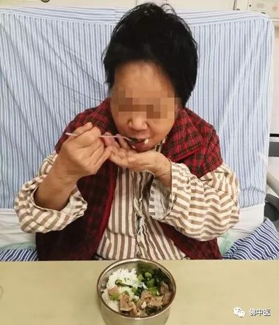 「专业」脑干梗塞合并吞咽障碍,脑病科吞咽专科护士有妙招