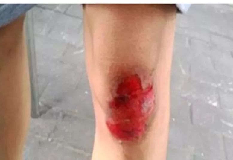 部队军医怎么训练,军医在线训练视频教程