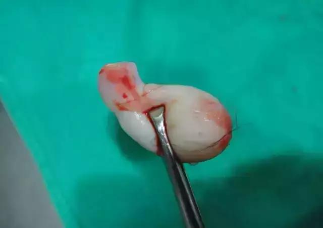 孕妇顺产36天后，莫名掉出“一块肉”，医生检查怒骂老公*兽禽**不如