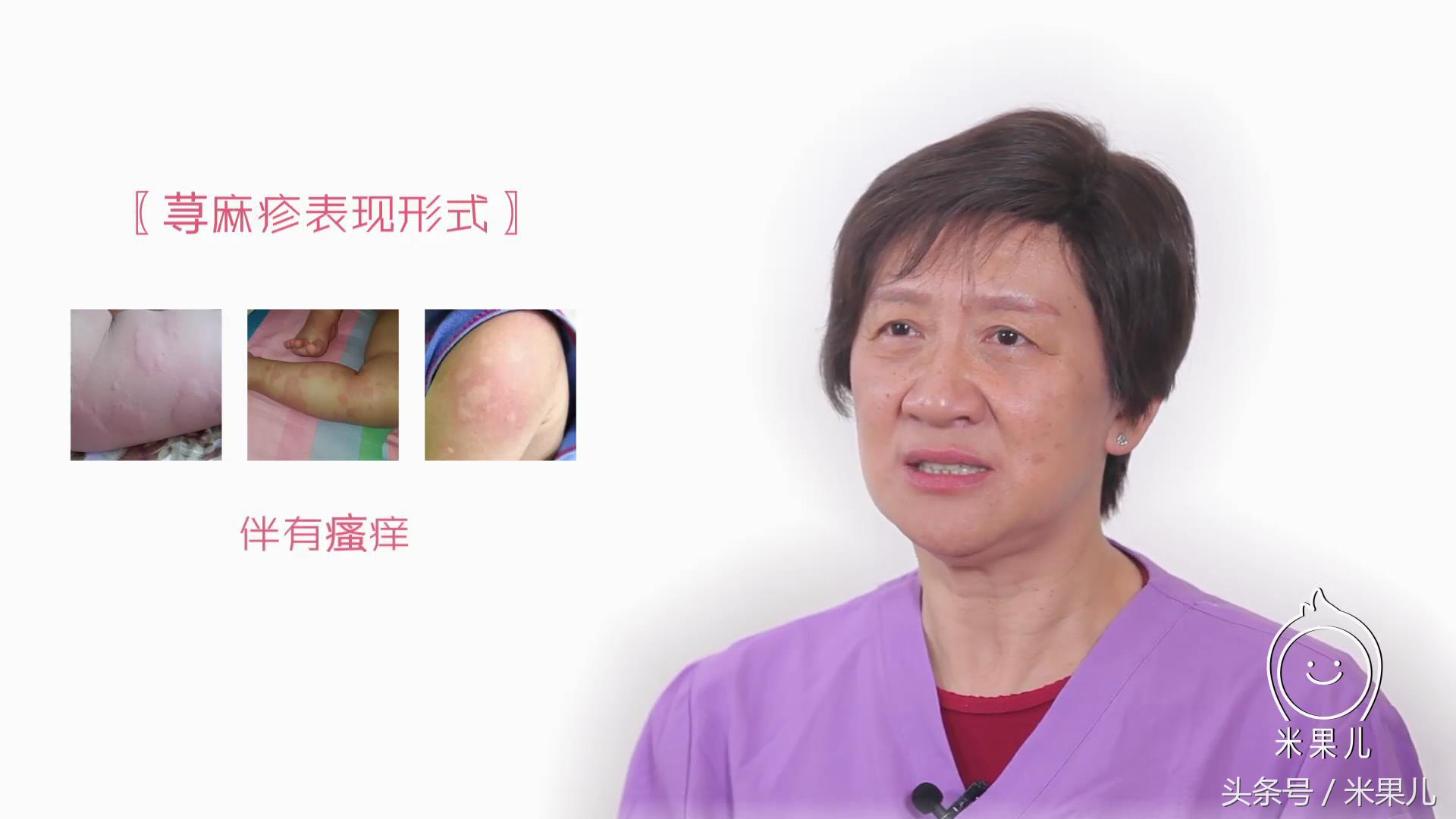 讲一下湿疹如何治疗,教你一分钟区分湿疹皮肤病