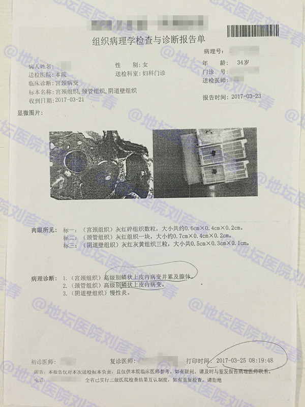 宫颈锥切后新感染hpv53型,宫颈活检低度病变hpv感染