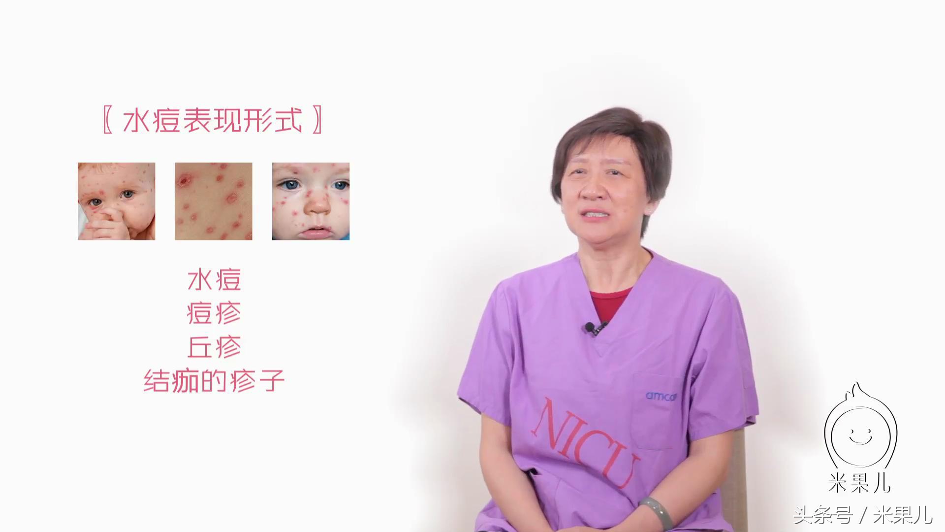 讲一下湿疹如何治疗,教你一分钟区分湿疹皮肤病