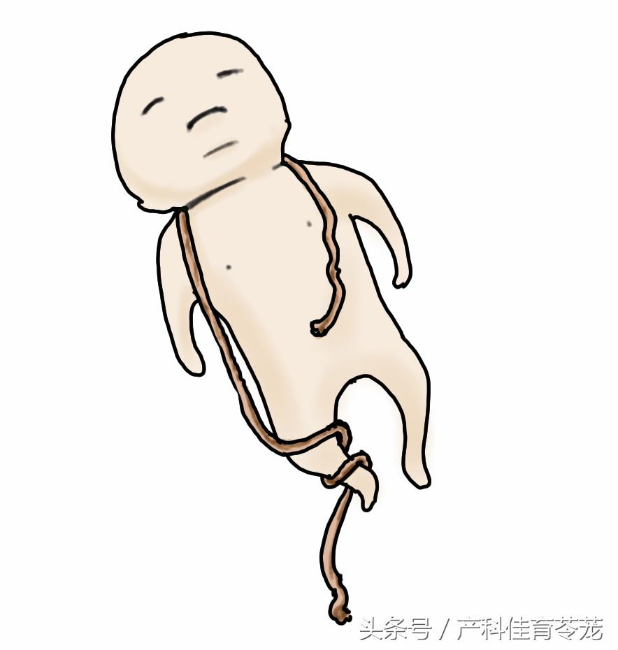 什么胎动需要警惕,胎动真的很重要