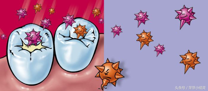 窝沟封闭注意事项,虫牙可以做窝沟封闭吗