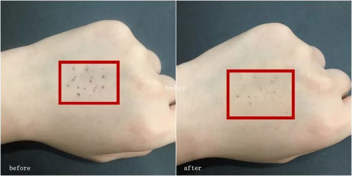 测评|资生堂完美意境粉底霜(内含100元内资生堂好物推荐)