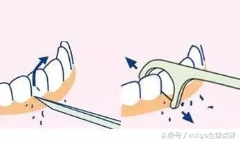 什么刷牙方法保护牙龈,怎么正确刷牙最干净无蛀牙