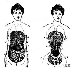 穿bra会得乳腺癌吗,不穿bra容易得乳腺癌