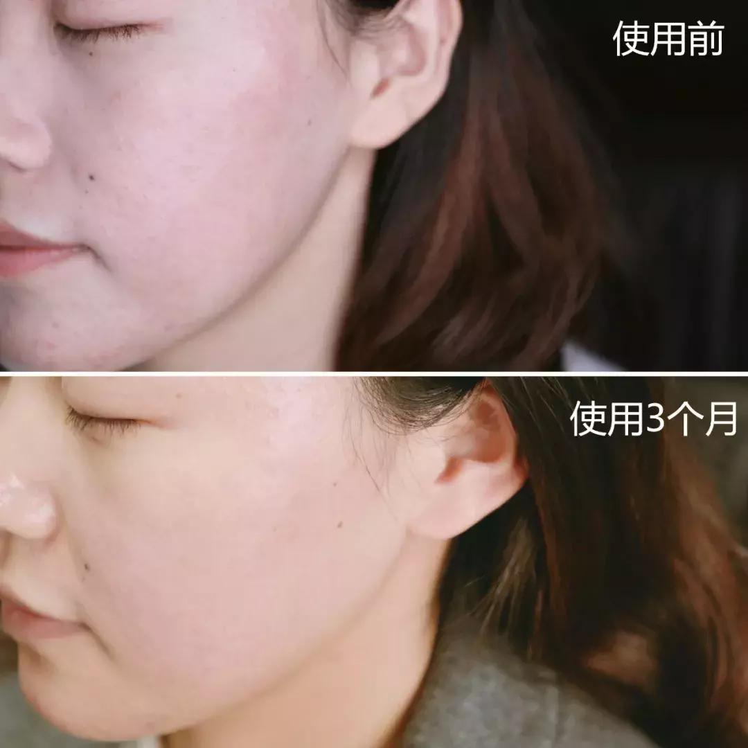 兰蔻小黑瓶和红腰子精华测评,资生堂红腰子精华和兰蔻小黑瓶