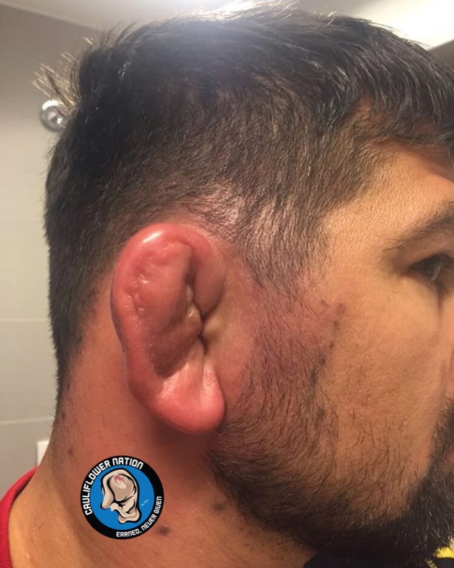 鐩村嚮鎷冲嚮閫夋墜鑰虫湹,鐩村嚮鎼忓嚮