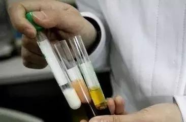 血里有油怎么排出,血里有油吃什么清得快