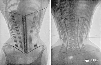 穿bra会得乳腺癌吗,不穿bra容易得乳腺癌