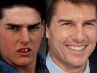 隐形矫正免费试戴，《芳华》女主也来打Call