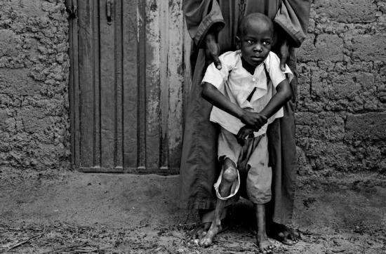 可能是2018年最重要的一件事之一:脊髓灰质炎或被彻底消灭