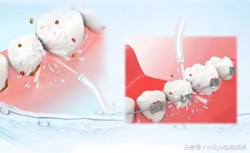 什么刷牙方法保护牙龈,怎么正确刷牙最干净无蛀牙