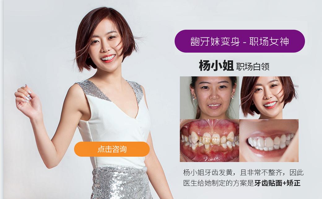 隐形矫正免费试戴，《芳华》女主也来打Call