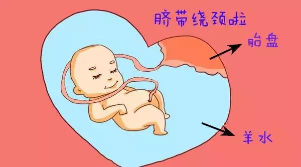 教你读懂产检b超单上英文缩写,如何看懂16周产检b超