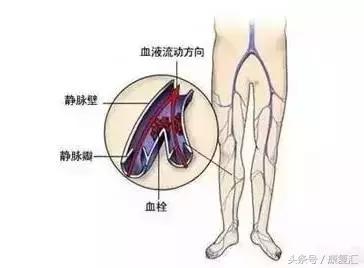 怎么矫正不良身姿,腰椎侧弯骨盆倾斜可以矫正过来吗
