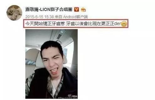 隐形矫正免费试戴，《芳华》女主也来打Call