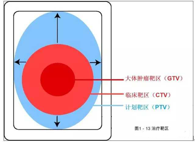 放疗副作用产生的原理及应对方法,宫颈癌手术后放疗怎么避免副作用