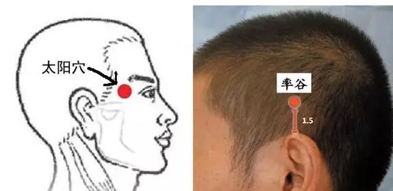 揉耳垂治偏头痛,偏头痛耳垂放血