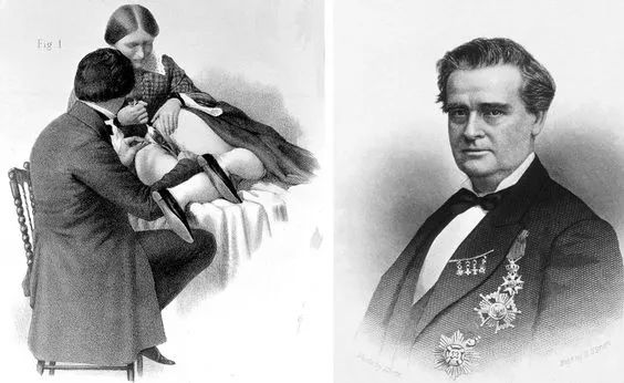 他完成首例妇科手术,被誉为女性的恩人,却因一场实验被批为恶魔