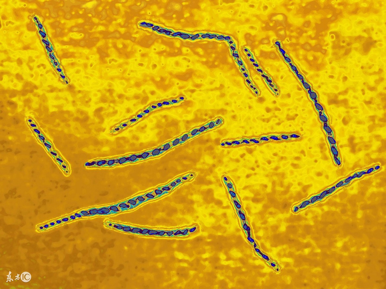 梅毒是怎么样才知道的,梅毒是怎么样的打一针多少钱