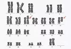 胎停育的大部分责任,胎停育太可怕了怎么预防