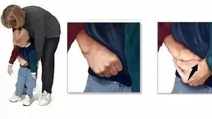 海姆立克急救法儿童救妈妈,海姆立克急救法救女士