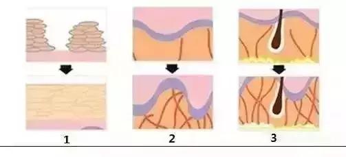 做完线雕真的会年轻吗,经常做线雕面部会年轻吗