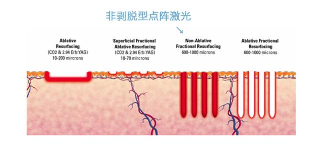 美容仪器大盘点！大排灯、射频仪真的有必要买吗？