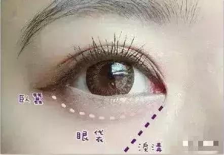 做完线雕真的会年轻吗,经常做线雕面部会年轻吗