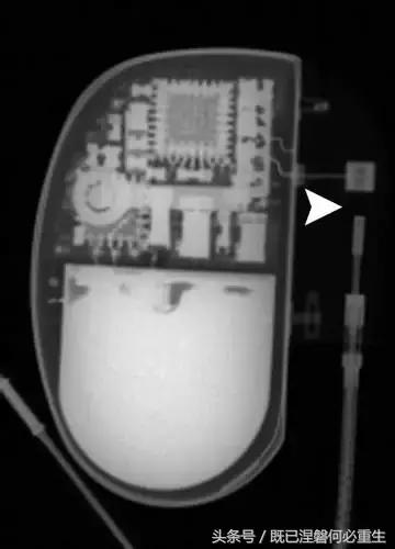 心内除颤仪和起搏器有什么区别,起搏器除颤仪