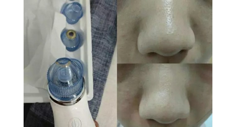 女朋友拒绝和我接吻,老婆拒绝接吻的原因