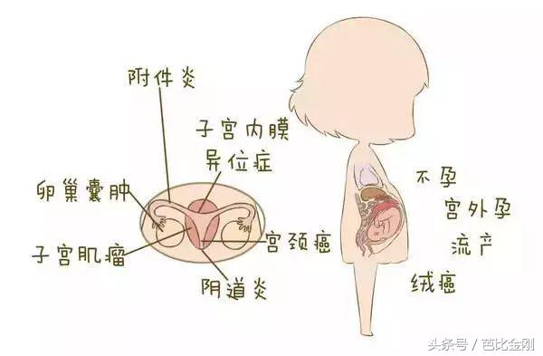 为什么妇科疾病越治越严重,为何妇科疾病难治