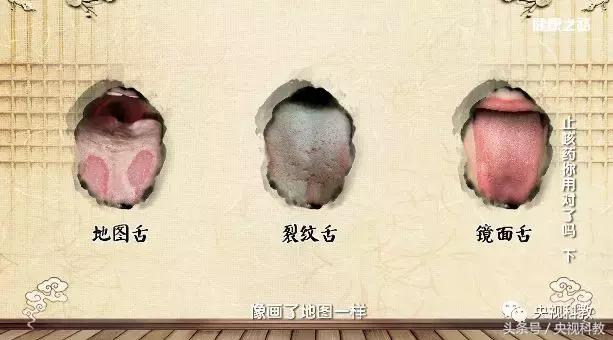 健康之路止咳,最全的止咳中成药讲解