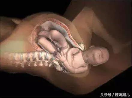 顺产是撕心裂肺的疼？高清图揭示分娩的真相！