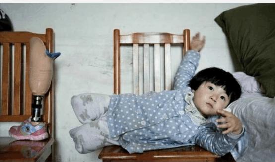 两岁小孩出车祸,三岁小孩出车祸没腿