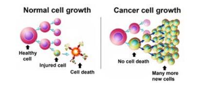 淋巴细胞白血病cll是什么意思,急性淋巴白血病l2型要怎么治