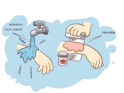 皮肤烫伤起水泡如何正确处理,被开水烫伤后正确的处理方法是