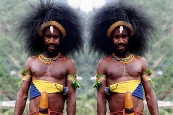 世界上最奇葩的人体器官,世界最复杂的人体器官排名