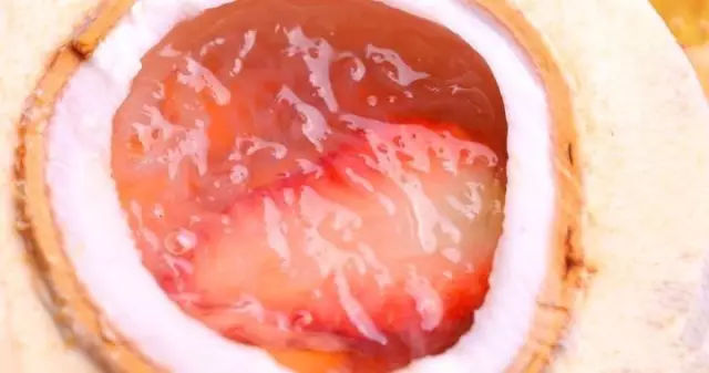 孕美聪燕窝50问（专业版）