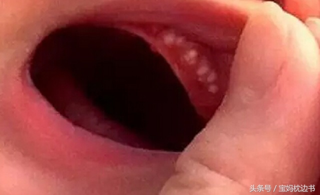 宝妈都有什么症状,新生儿不要担心的9种异常