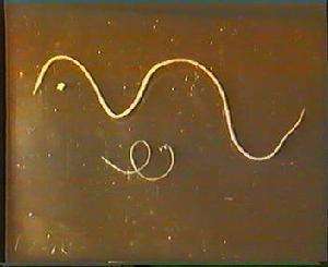 冬天，希望我们的尿不要像雪一样白