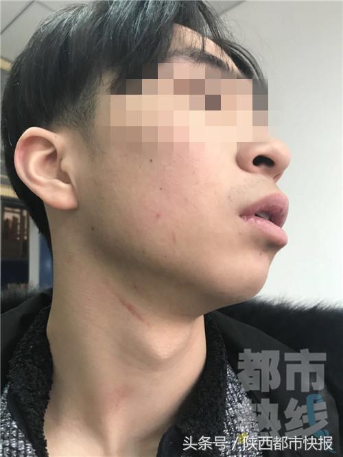 一学生被老师踢断腿骨,学生被老师踢断腿骨教育局证实